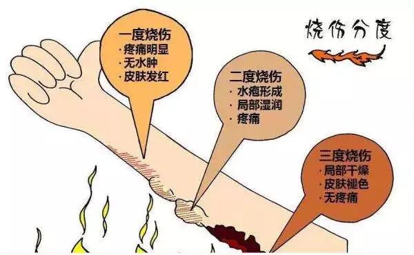 产妇双腿被热水瓶烫伤，月子中心全责，深度解读与说明，社会责任方案执行_挑战款38.55